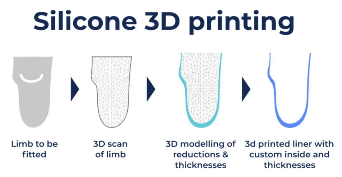 Unsere Lösung: 3D-gedruckte Silikonliner