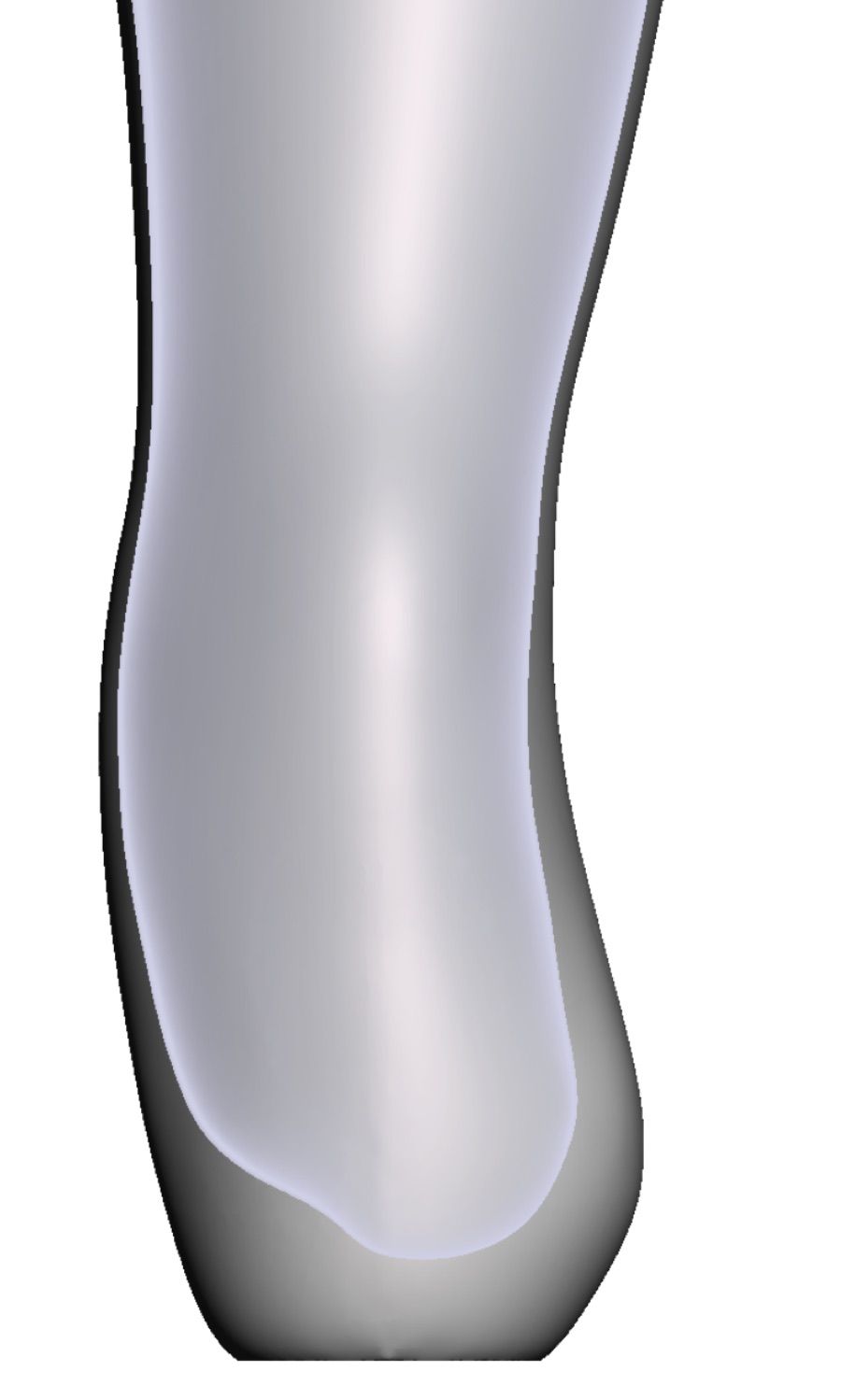 Exostose — 3D-Modell