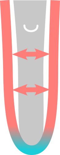 No adequate size of standard liner available