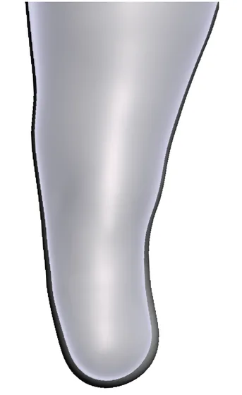 Conical Thigh — 3D model