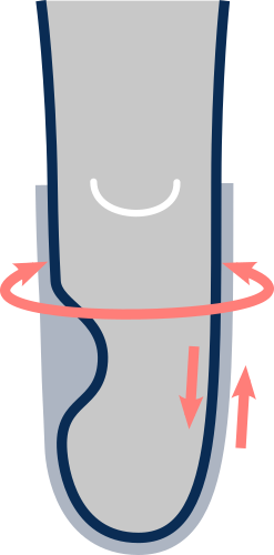 Necessarie modifiche dell'invasatura (invasatura morbida, aperture modulari)